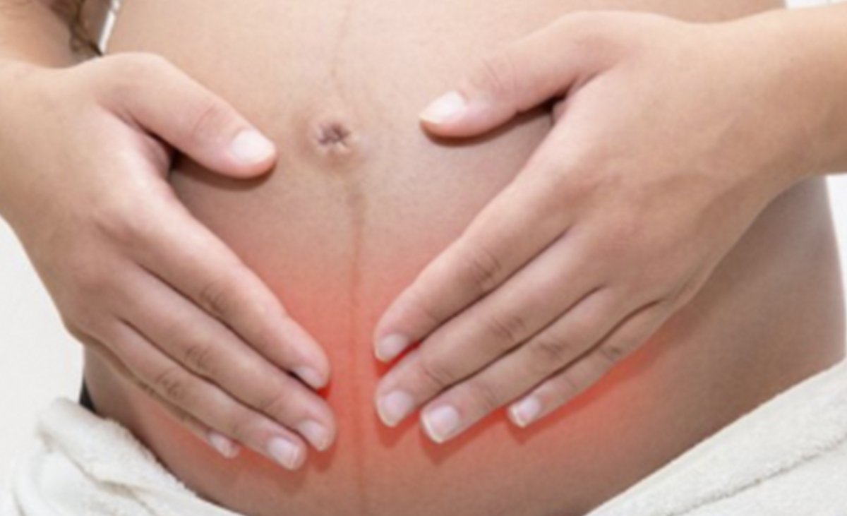 Endometriose Grau IV e Gravidez: É Possível Engravidar com Endometriose Severa?