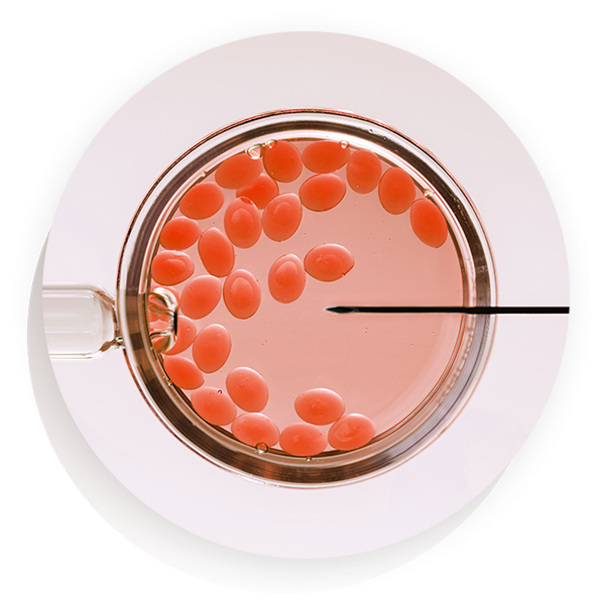 Fertilização in vitro (FIV)