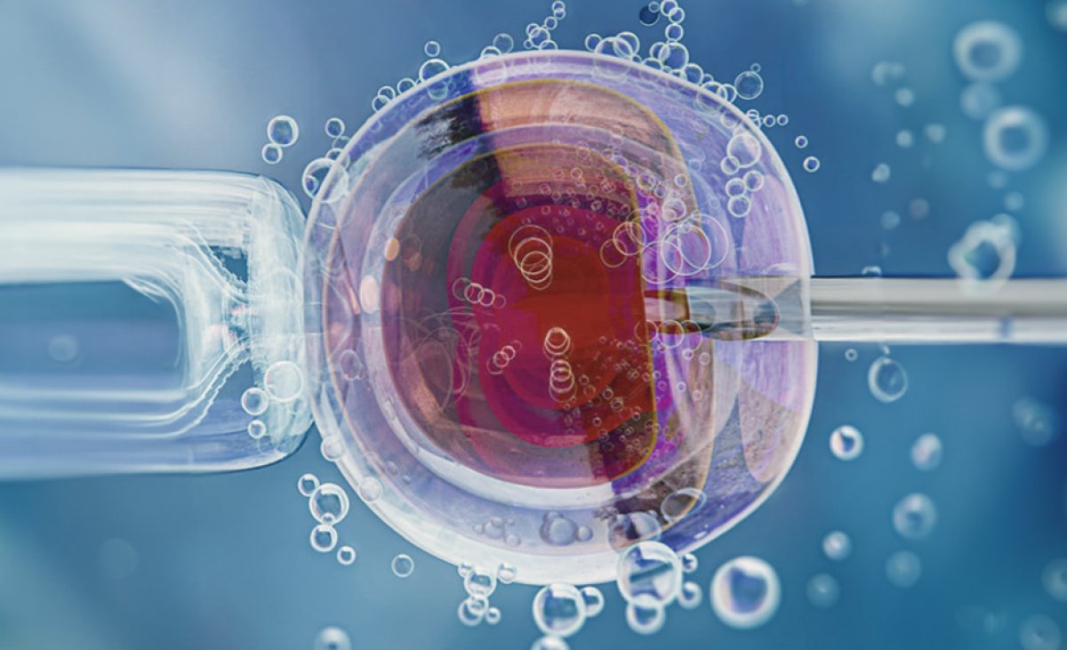 Fertilização in Vitro Valor FIv Preço