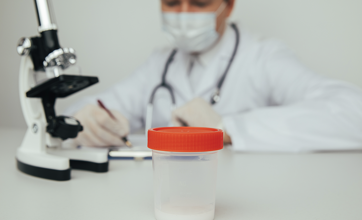 Oligospermia e Baixa Contagem de Esperma
