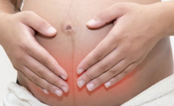Endometriose Grau IV e Gravidez: É Possível Engravidar com Endometriose Severa?