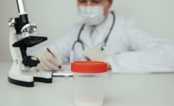 Oligospermia e Baixa Contagem de Esperma